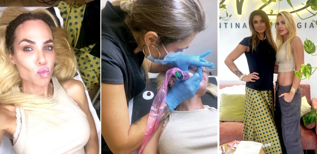 Ilary Blasi, forse ferita nell'orgoglio dopo il tradimento, vuole essere la più bella: nuovo trattamento labbra Ilary Blasi, forse ferita nell'orgoglio dopo il tradimento, vuole essere la più bella: nuovo trattamento labbra