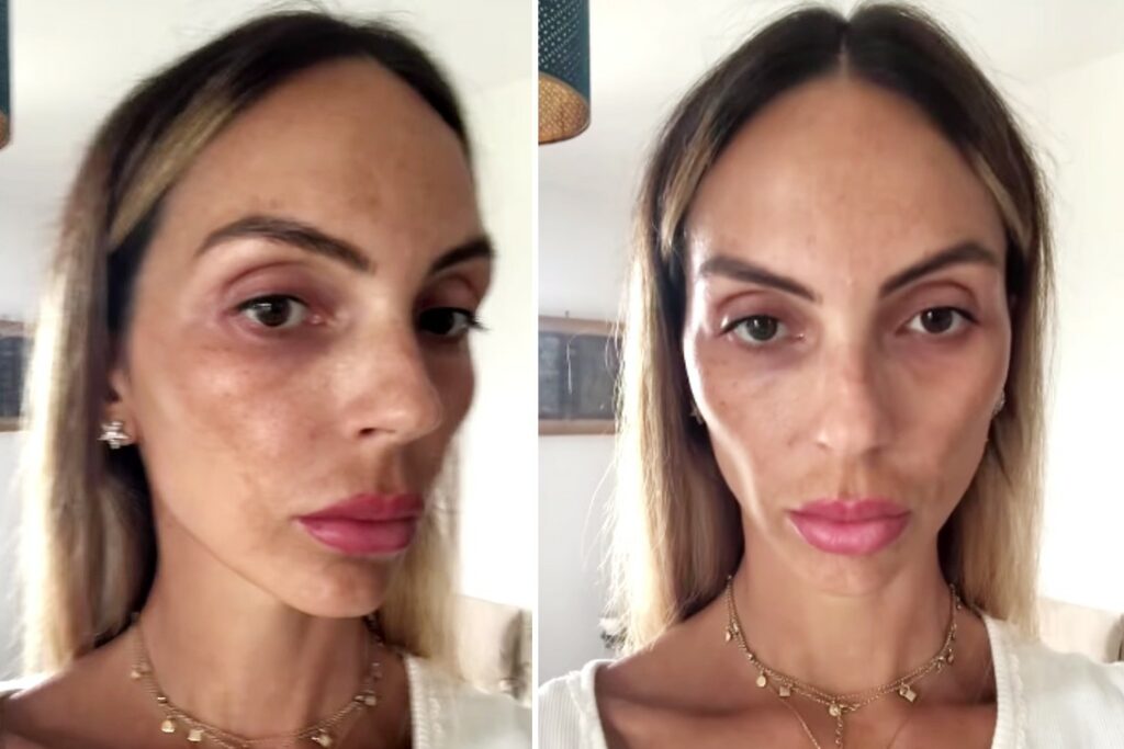 Sarah Nile irriconoscibile, mostra gli effetti della PMA per rimanere incinta: ''Questa sono io'' Sarah Nile irriconoscibile, mostra gli effetti della PMA per rimanere incinta: ''Questa sono io''