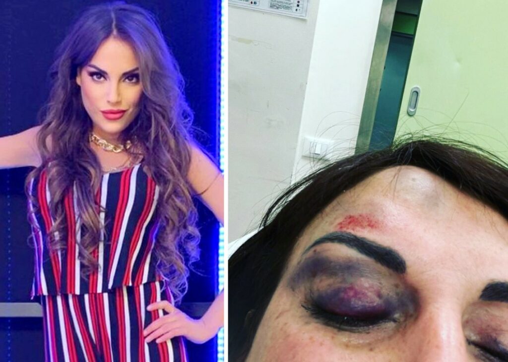 Francesca De André racconta di quando è stata portata in ospedale con ambulanza e Carabinieri: ''Ero messa male''