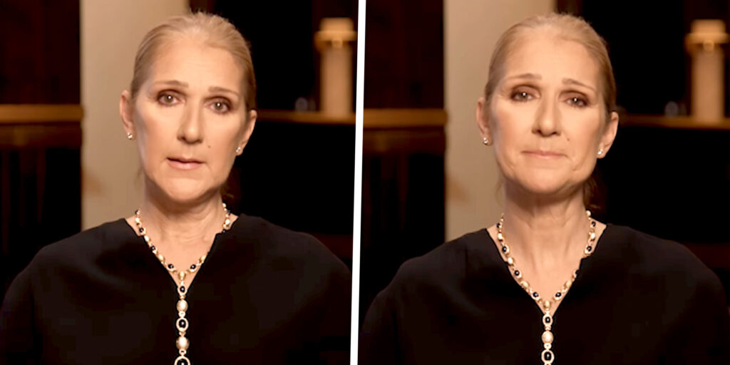 Celine Dion è malata, annuncio in lacrime: ''Ho la sindrome dell’uomo rigido''. Ecco di cosa si tratta Celine Dion è malata, annuncio in lacrime: ''Ho la sindrome dell’uomo rigido''. Ecco di cosa si tratta