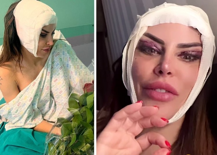 Guendalina Tavassi, nuovo intervento di chirurgia estetica