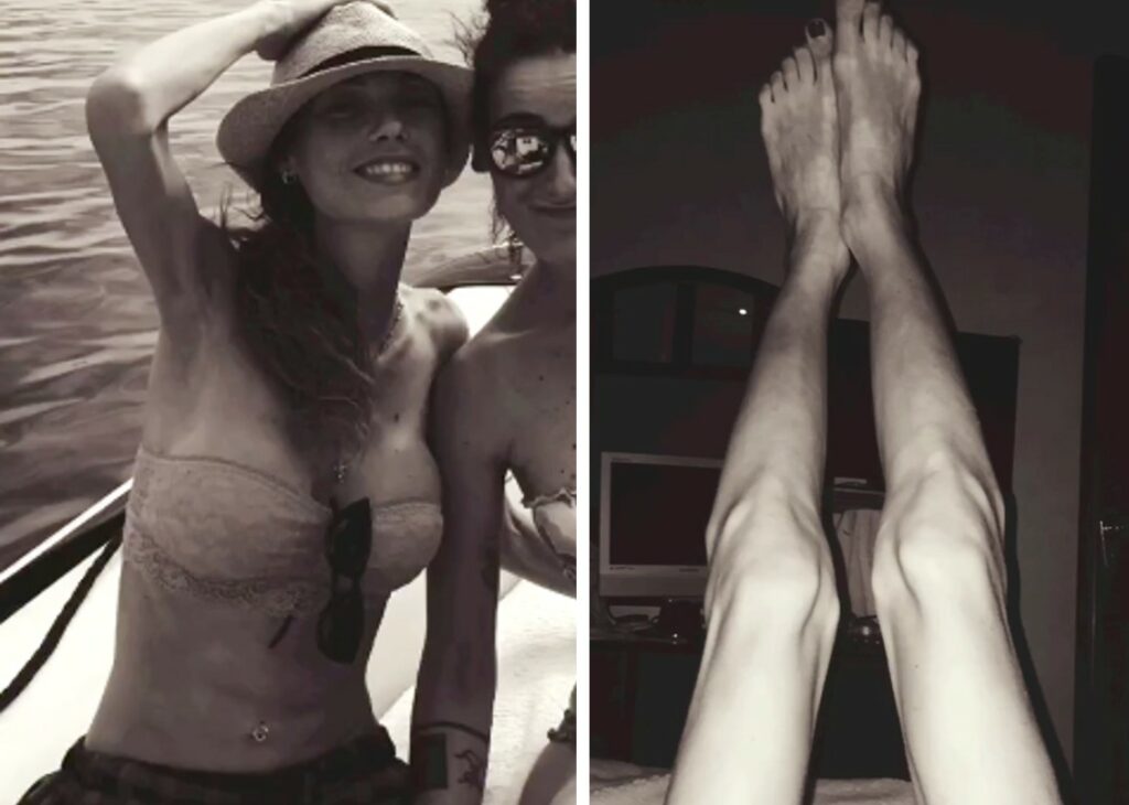 Rosalinda Cannavò torna a mostrare il corpo martoriato dall'anoressia: ''Condivido per chi lotta'' Rosalinda Cannavò torna a mostrare il corpo martoriato dall'anoressia: ''Condivido per chi lotta''