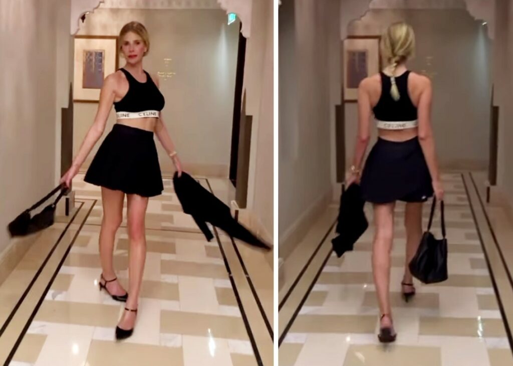 ''Mi hanno attaccato gli arti inferiori al contrario'': Alessia Marcuzzi mostra le gambe 'storte' e si prende in giro da sola