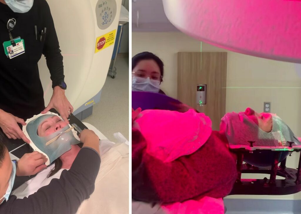 L'attrice americana Shannen Doherty e il cancro all'ultimo stadio: ''Ci sono metastasi al cervello''. Pubblica le immagini crude della tac L'attrice americana Shannen Doherty e il cancro all'ultimo stadio: ''Ci sono metastasi al cervello''. Pubblica le immagini crude della tac