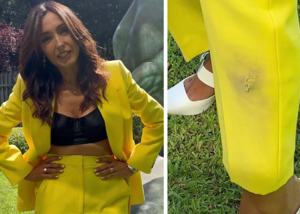 Caterina Balivo, incidente in conferenza stampa Rai davanti a decine di fotografi: ecco cos'è successo Caterina Balivo, incidente in conferenza stampa Rai davanti a decine di fotografi: ecco cos'è successo