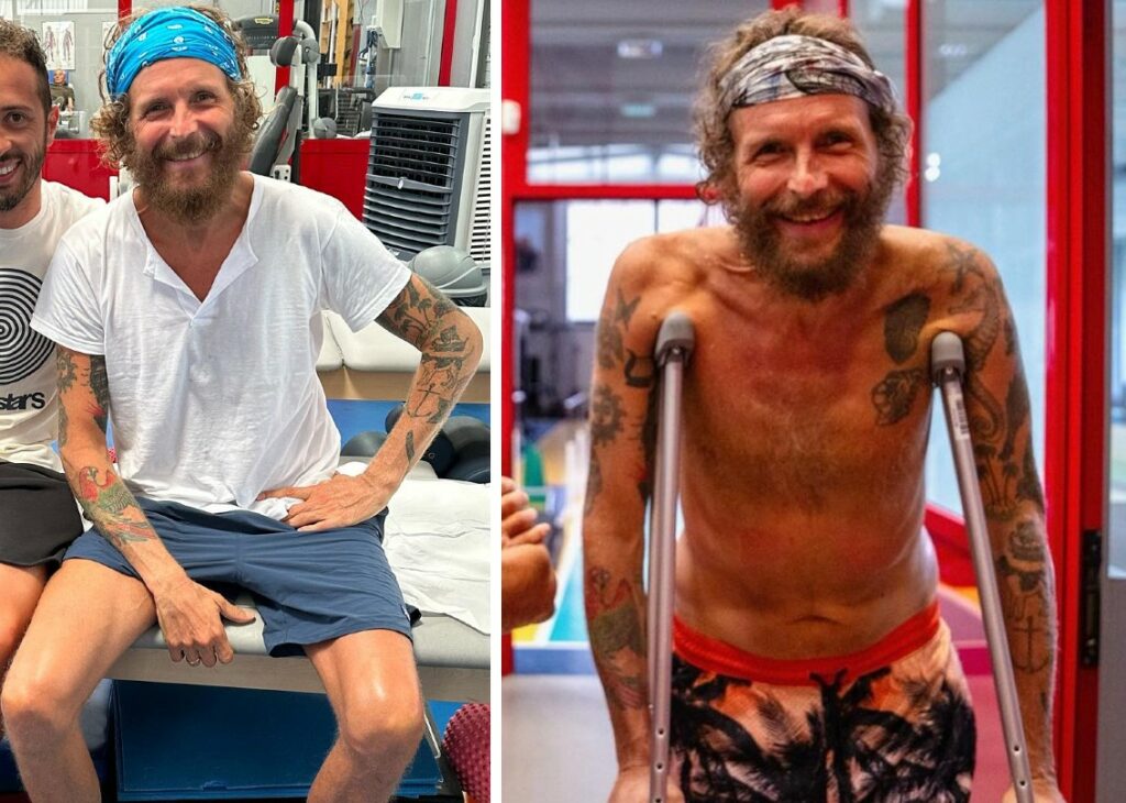 ''Durante l’operazione si sono dimenticati di riallineare il femore, ho una gamba più corta'': la rivelazione sconcertante di Jovanotti ''Durante l’operazione si sono dimenticati di riallineare il femore, ho una gamba più corta'': la rivelazione sconcertante di Jovanotti