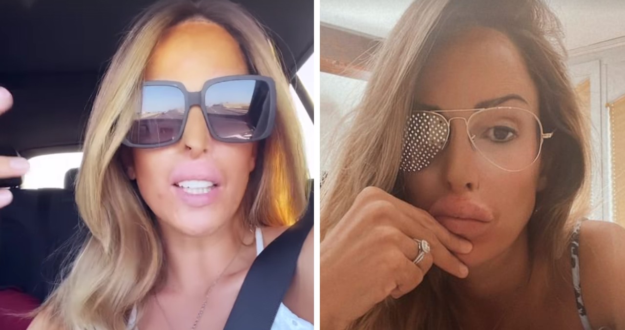 Gessica Notaro asfalta gli haters 'Ecco cosa mi sono rifatta' Gossip