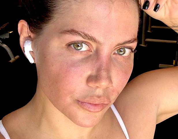 ''Non voglio essere compatita, i miei figli hanno singhiozzato'': Wanda Nara parla per la prima volta della sua malattia