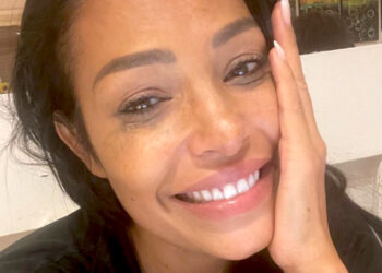 Carolina Marconi riceve il risultato della risonanza al fegato e scoppia a piangere sul social: ecco cos'è la macchia sospetta