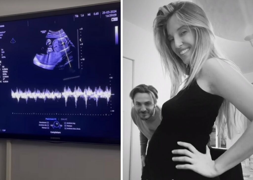 ''Sono di 5 mesi ma ne dimostro 8'': Guenda Goria incinta va a fare l'ecografia con tutta la famiglia, le immagini