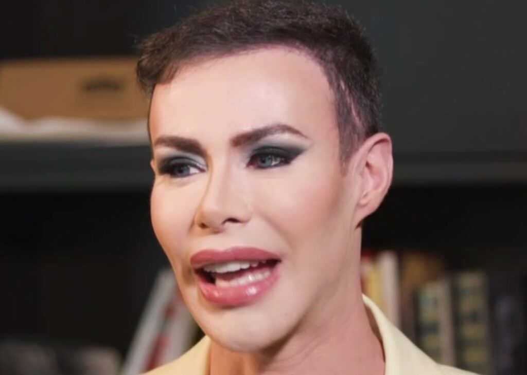 ''Mi ci compravo casa'': l'ex gieffino Angelo Sanzio rivela quanto ha speso per tutti i suoi interventi di chirurgia estetica