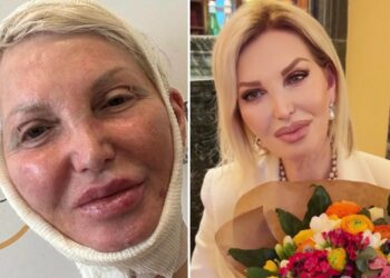 ''Mi mostro così per farvi venire un po' di invidia'': la Marchesa d'Aragona si fa vedere dopo il lifting al viso