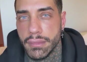 Drusilla Gucci svela cosa prova guardando i nuovi occhi di Francesco Chiofalo