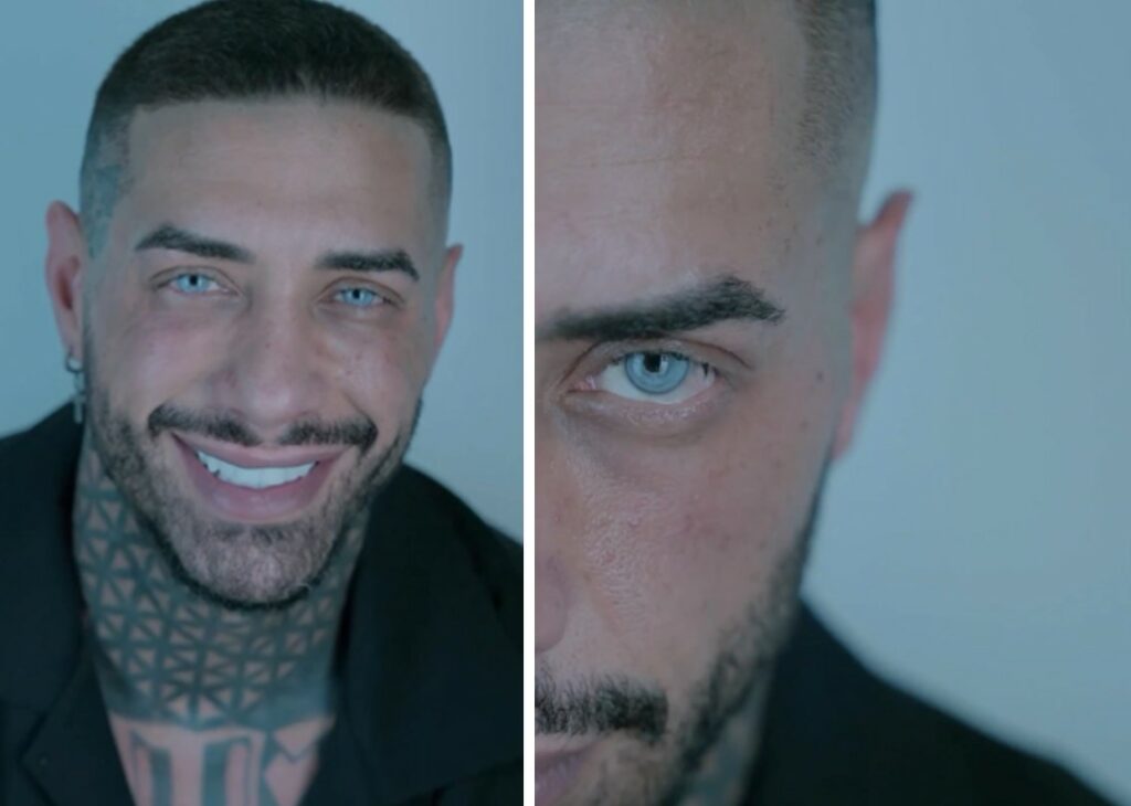 Francesco Chiofalo mostra per la prima volta gli occhi azzurrissimi dopo l'operazione per il cambio colore: guarda Francesco Chiofalo mostra per la prima volta gli occhi azzurrissimi dopo l'operazione per il cambio colore: guarda