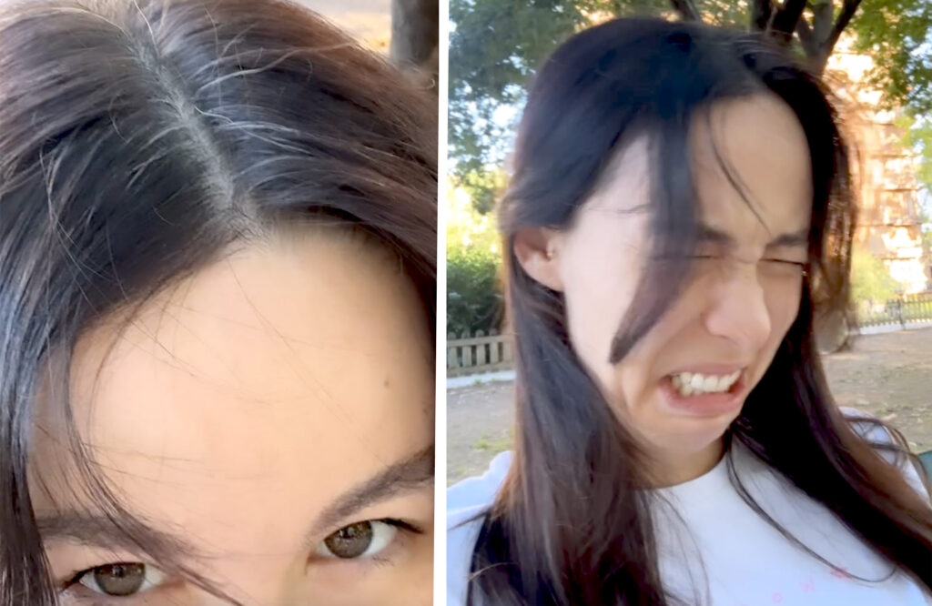 ''Non ho niente contro i capelli bianchi'': Aurora Ramazzotti a 27 anni fa autoironia sulla chioma che ha già la ricrescita canuta