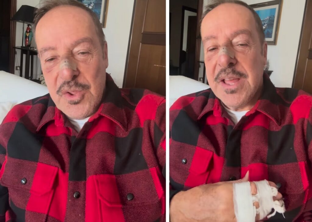 ''Fratture a naso e mano, poteva andare peggio, ho denunciato'': Massimo Lopez riappare dopo essere stato investito in strada