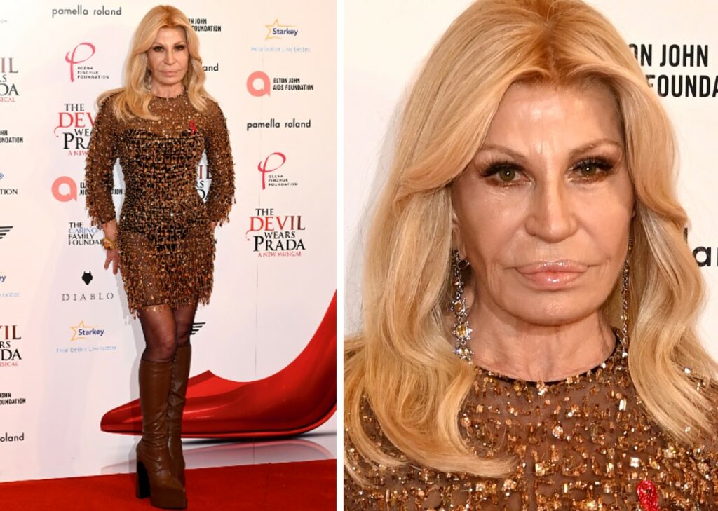 Donatella Versace torna in pubblico dopo una ''incredibile trasformazione'': nuovo lifting per la stilista? Guarda Donatella Versace torna in pubblico dopo una ''incredibile trasformazione'': nuovo lifting per la stilista? Guarda