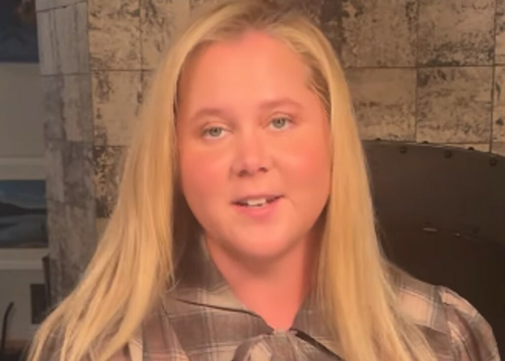 Amy Schumer ha scoperto di avere una malattia grazie ai commenti degli hater sul suo viso