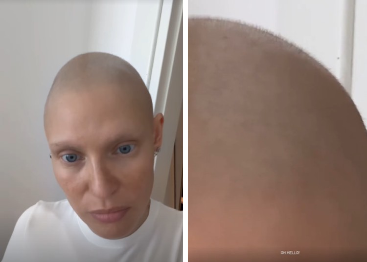 Bianca Balti mostra la ricrescita dei capelli