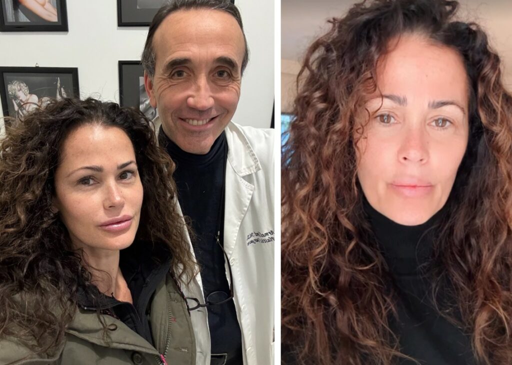 ''Fate pace col cervello'': Samantha De Grenet si altera per le critiche ricevute dopo la visita dal chirurgo plastico e le punturine ''Fate pace col cervello'': Samantha De Grenet si altera per le critiche ricevute dopo la visita dal chirurgo plastico e le punturine