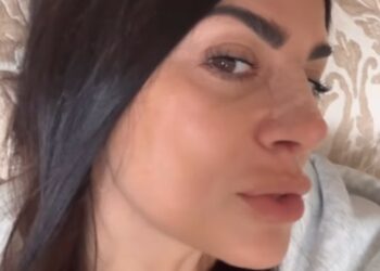 ''Il naso è stupendo'': Serena Enardu ha fatto la rinoplastica