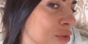 ''Il naso è stupendo'': Serena Enardu ha fatto la rinoplastica