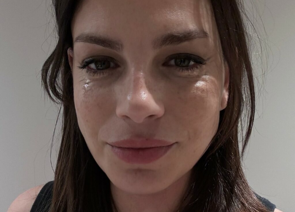 ''Ho visto mia mamma e mio papà invecchiare di cent'anni di colpo'': Emma Marrone racconta il terribile periodo dopo la sua diagnosi di tumore