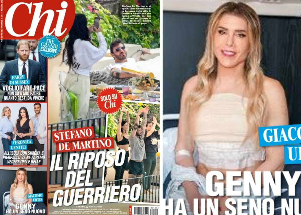 ''Ho voluto una terza'': il chirurgo estetico Giacomo Urtis rivela a sorpresa di aver fatto la mastoplastica ''Ho voluto una terza'': il chirurgo estetico Giacomo Urtis rivela a sorpresa di aver fatto la mastoplastica