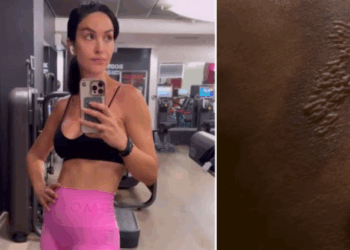 Piccolo incidente per Rosa Perrotta mentre si allena in palestra