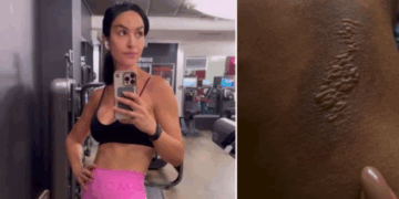 Piccolo incidente per Rosa Perrotta mentre si allena in palestra