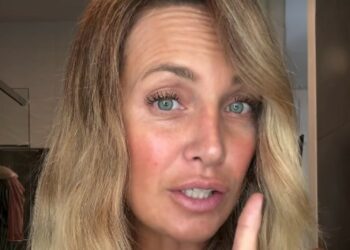 Katia Pedrotti sbotta per le critiche alla sua pelle