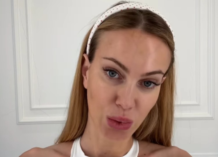 Taylor Mega spiega perchè fa il botox preventivo Taylor Mega spiega perchè fa il botox preventivo