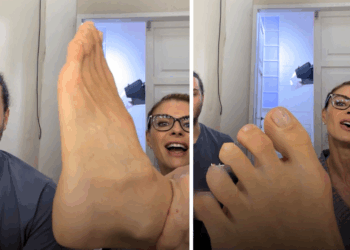 Martina Colombari fa felici i feticisti: mostra i piedi durante la diretta nonostante calli e cicatrici