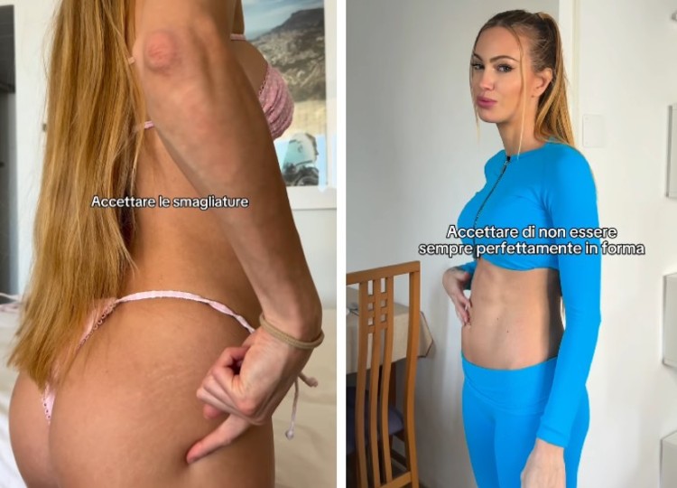Taylor Mega mostra con coraggio le smagliature e la cellulite Taylor Mega mostra con coraggio le smagliature e la cellulite