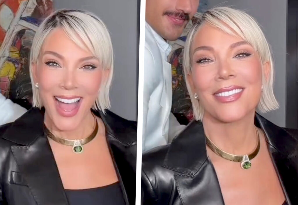 Kris Jenner sembra sempre più giovane: a 69 anni la mamma delle Kardashian cambia look dopo i nuovi ritocchi estetici Kris Jenner sembra sempre più giovane: a 69 anni la mamma delle Kardashian cambia look dopo i nuovi ritocchi estetici