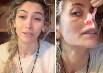 Paris Jackson, figlia di Michael, mostra il setto perforato a causa delle droghe Paris Jackson, figlia di Michael, mostra il setto perforato a causa delle droghe