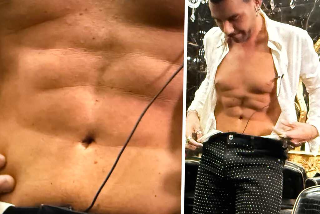 Federico Fashion Style a Le Iene mostra il risultato della sua addominoplastica: ''Mi ha cambiato la vita'' Federico Fashion Style a Le Iene mostra il risultato della sua addominoplastica: ''Mi ha cambiato la vita''