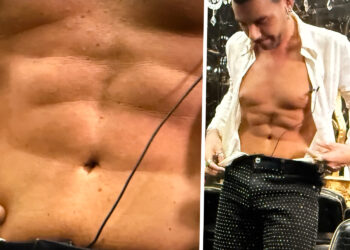 Federico Fashion Style a Le Iene mostra il risultato della sua addominoplastica: ''Mi ha cambiato la vita''