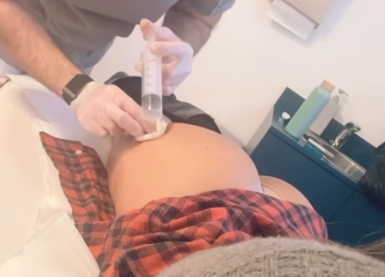 Belen Rodriguez combatte la ritenzione idrica con un trattamento  al lato b