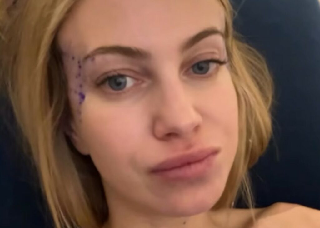 ''Non ve lo dirò mai'': Taylor Mega in clinica per un intervento ‘misterioso’ ne approfitta e mette un po’ di grasso in una parte del corpo ''Non ve lo dirò mai'': Taylor Mega in clinica per un intervento ‘misterioso’ ne approfitta e mette un po’ di grasso in una parte del corpo