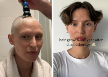 ''Un anno fa l’ultima chemio'': Bianca Balti pubblica le foto di quando era calva, i suoi capelli ora ricrescono in fretta, guarda