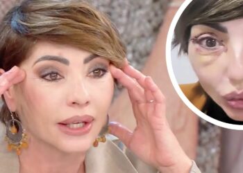 ''Guardate i miei occhi, sono bellissima'': Ilaria Galassi di 'Non è la Rai' si mostra soddisfatta in tv dopo l’intervento estetico