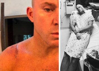''Colpa mia per non aver chiesto'': l’attore Channing Tatum sorpreso dalla grandezza della cicatrice del suo recente intervento, foto