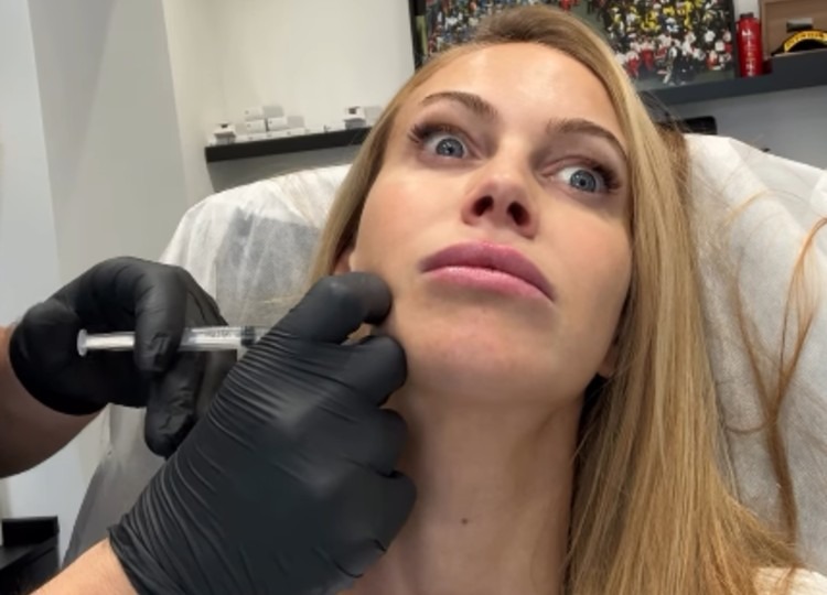 Taylor Mega mostra il suo appuntamento con il botox Taylor Mega mostra il suo appuntamento con il botox