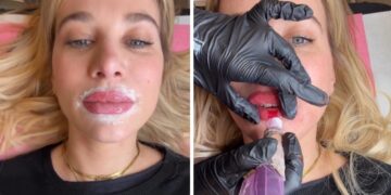 ''Risultato pazzesco!'': Clizia Incorvaia rivela il segreto delle sue labbra perfette