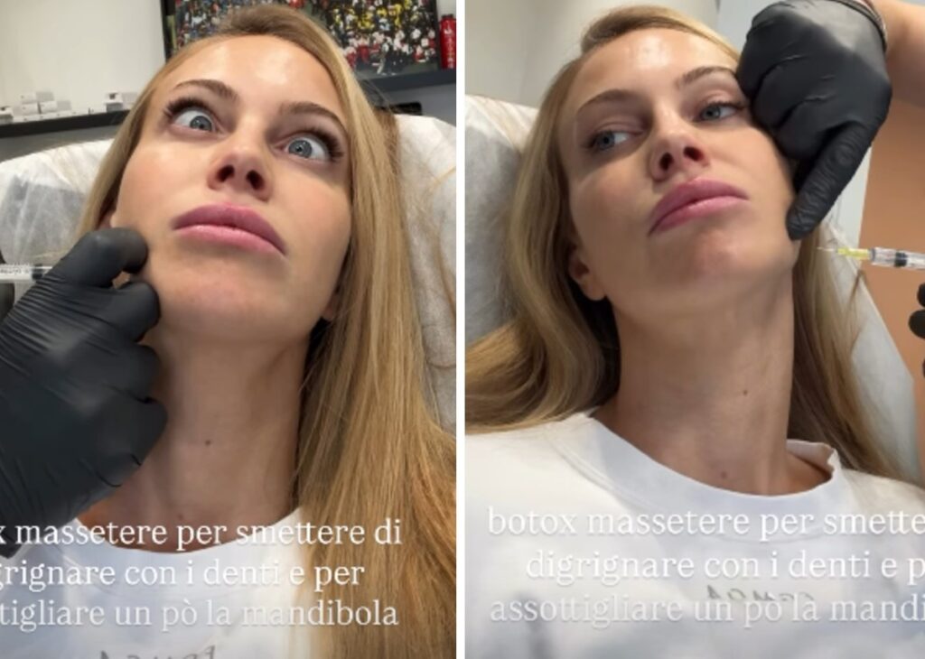 ''18.30 vengo a farmi il Botox'': Taylor Mega va dal chirurgo estetico per un ritocchino salvifico, ecco quale