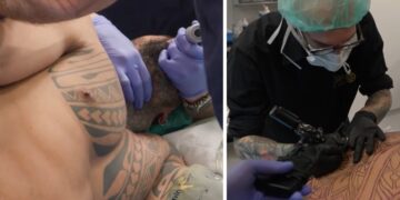 ''Il primo in Italia'': Francesco Chiofalo in tv mostra la sua operazione per il tatuaggio istantaneo e svela il disegno scelto, guarda