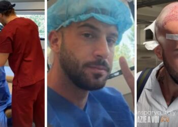''Non si torna più indietro!'': Andreas Muller ha deciso di risolvere il suo ‘problemino’ e si è sottoposto a un trapianto di capelli, guarda ''Non si torna più indietro!'': Andreas Muller ha deciso di risolvere il suo ‘problemino’ e si è sottoposto a un trapianto di capelli, guarda