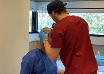 Andreas Muller parla del suo trapianto di capelli Andreas Muller parla del suo trapianto di capelli
