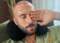 Andreas Muller mostra il post trapianto di capelli: guarda Andreas Muller mostra il post trapianto di capelli: guarda